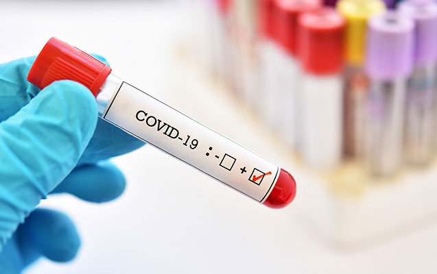 Türkiyədə bu gün koronavirusdan 186 nəfər öldü